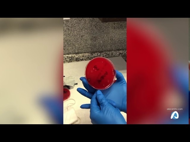 Reutilizar la mascarilla puede traerte consecuencias para la salud